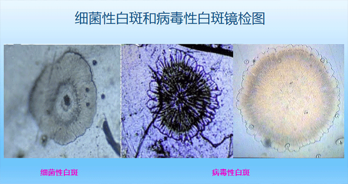虾疫病检测组织